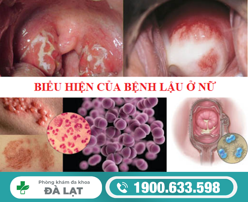 Hình ảnh minh họa